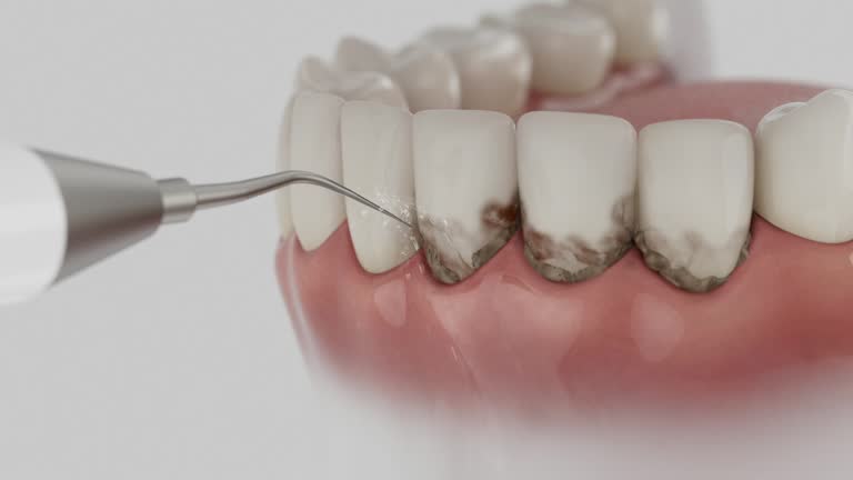 Trusted Emergency Dentist service in Quail Ridge, FL - Dentist Open Now